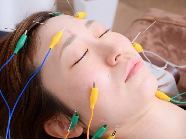 パルス通電美容鍼